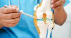 بدون جراحة.. كيف يعتني مريض الفُصال العظمي بركبتيه؟